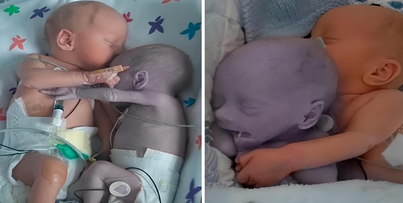 "Unbelievable Miracle: Baby's Touch Revives Dying Twin"