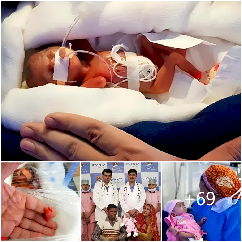 Tiny Warrior: Baby Girl, Born 3 Months Premature, Weighs Less Than a Chocolate Bar, Defying All Odds.